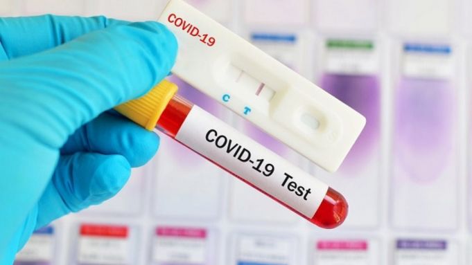 Un studiu a arătat pentru prima oară că anticorpii de COVID-19 pot rezista în corp cel puţin trei luni după infectare