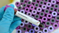 Studiu: Coronavirusul s-ar putea răspândi mai rapid decât se credea