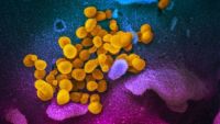 Coronavirusul supravieţuieşte la temperaturi de peste 60 de grade – studiu francez