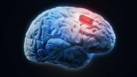 Un implant cerebral a tratat cu succes depresia severă în timpul unor cercetări revoluţionare